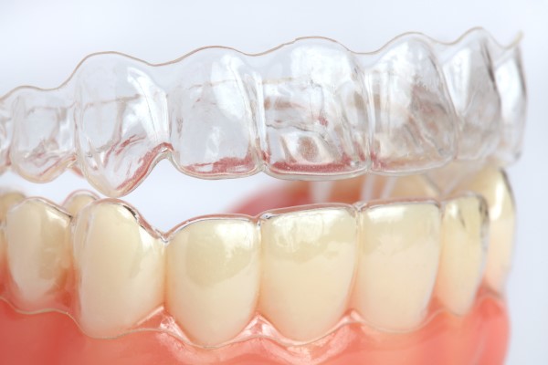 How Clear Aligners Can Improve Your Smile